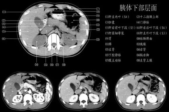 干货满满443例实例教你解读腹部ct