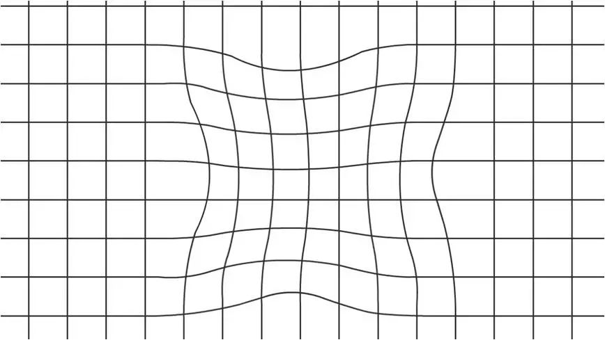 瑞健国际扭曲的世界水肿的黄斑糖尿病惹的祸