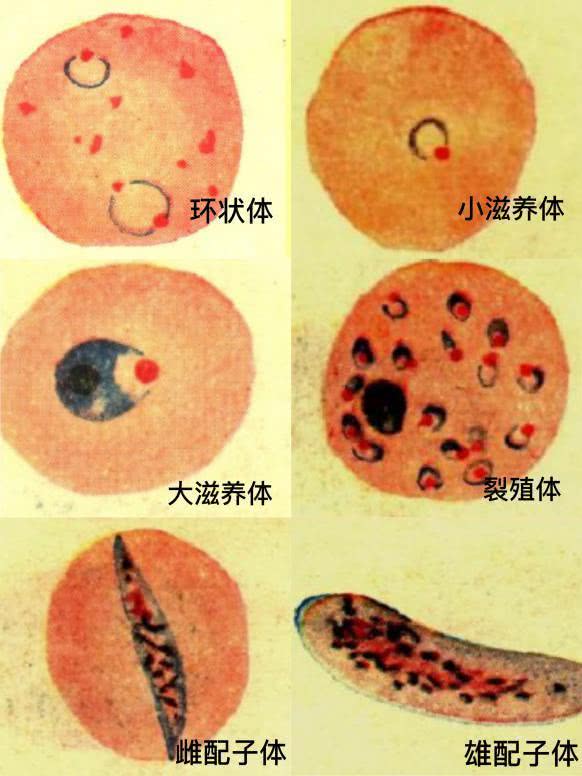 疟原虫雄配子体手绘图图片