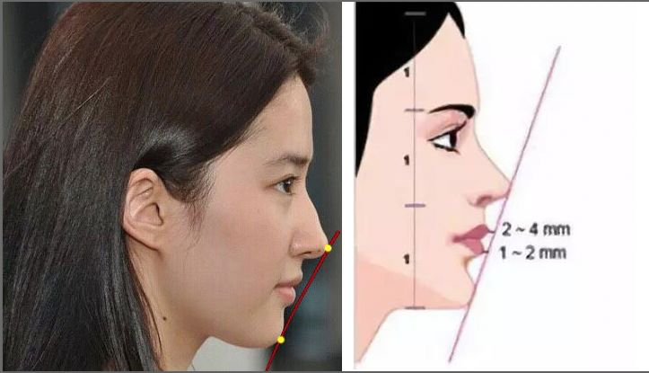 到底该不该矫正牙齿,先看看这篇自测一下吧 (转载)