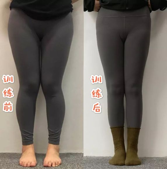 "让她感到无比尴尬幸好有rosie的帮助只上了8节课,现在腿型明显有质的