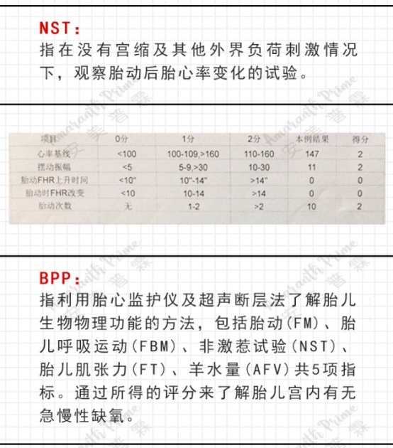 无应激试验(nst)和胎儿生物物理评分(bpp)脐动脉彩色多普勒:根据临床