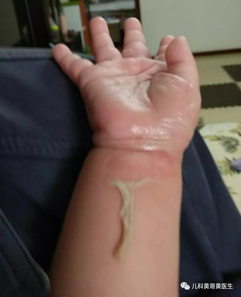 来自福建的4岁男孩童童饿了,看到妈妈刚煮好的米线,手舞足蹈地跑了