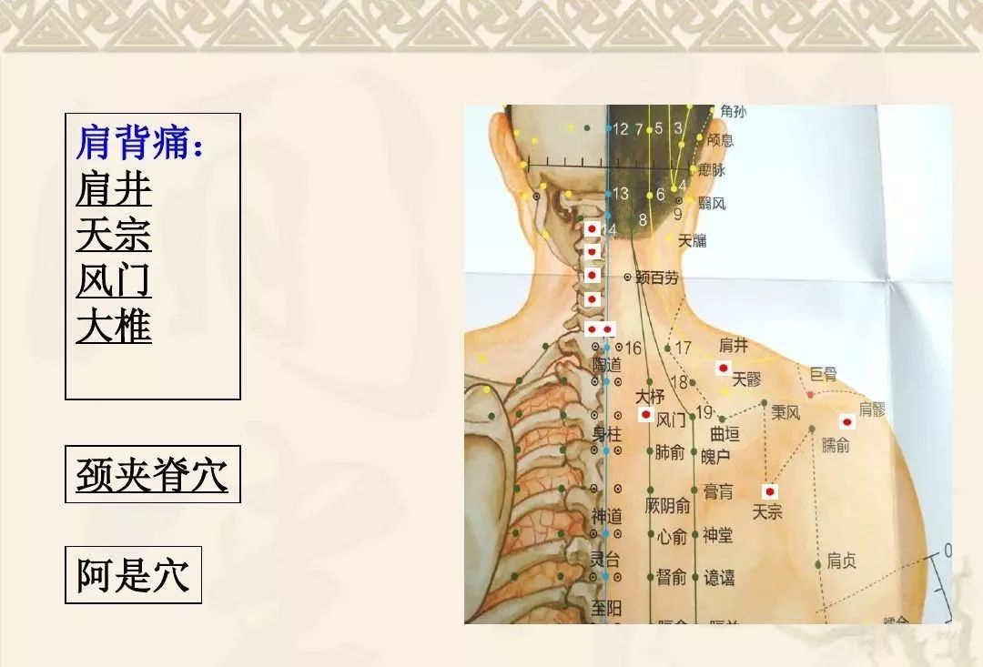 颈肩腰腿痛的常用穴位详解