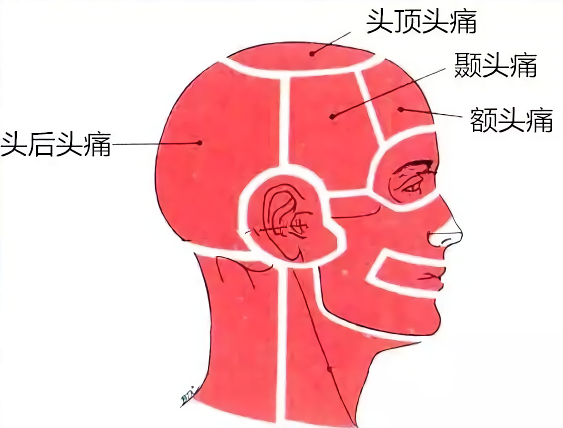 头痛每个人的具体的头痛位置都不太一样,如前额,颞部(nie,指的是头部