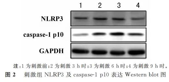 論著trpv4活化調控炎性小體nod樣受體家族3在小鼠膀胱上皮細胞損傷中