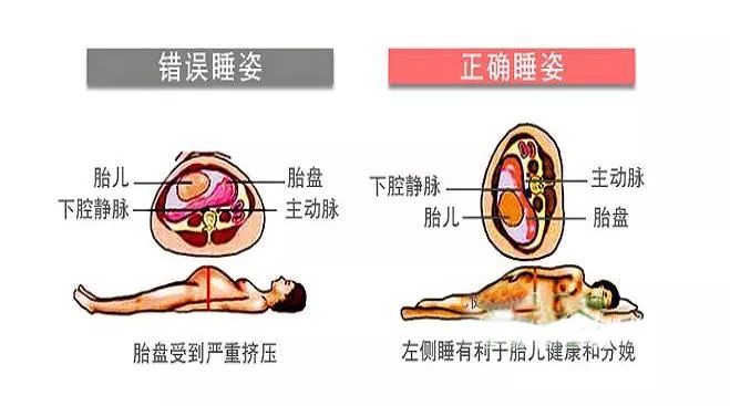 孕妇专用枕能缓解睡觉时大肚子的压力,6