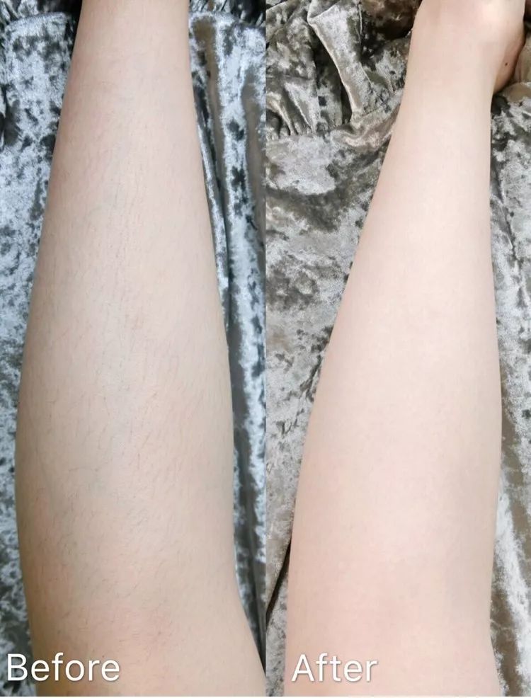 体毛旺盛超尴尬喷一喷60秒无感脱毛还能抑制体毛生长