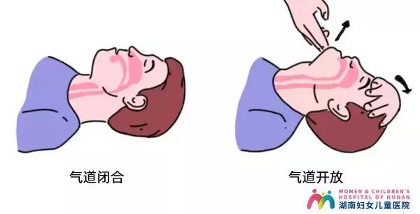 这个意思就是,把气管拉直"b":人工呼吸捏紧鼻孔,用口唇包住患者口唇