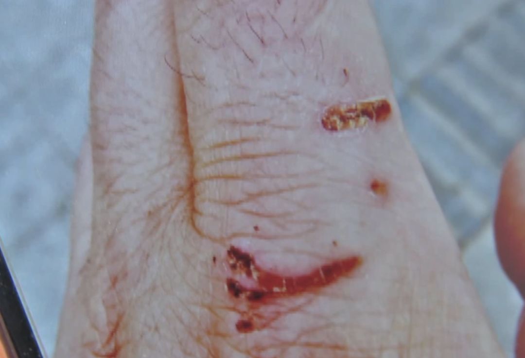 可怕黑背犬咬死泰迪咬伤小孩湖北最严禁狗令来了