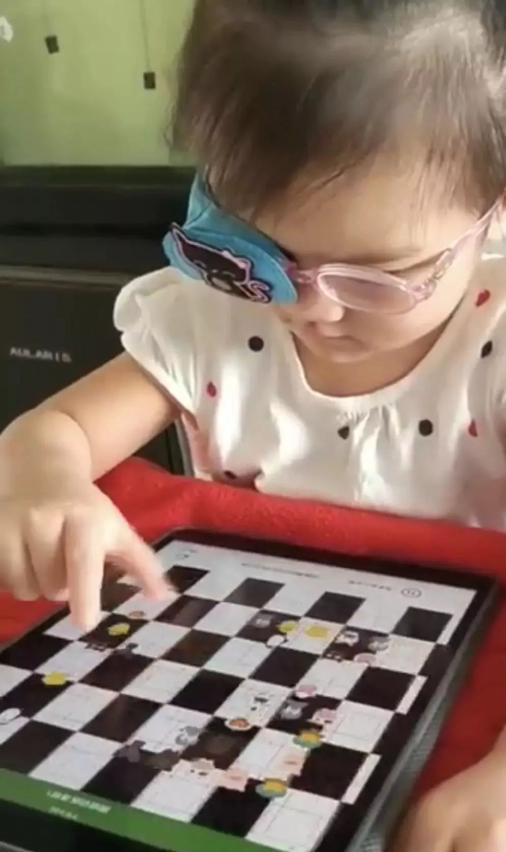 在家弱视训练一个月视力从005提升到06