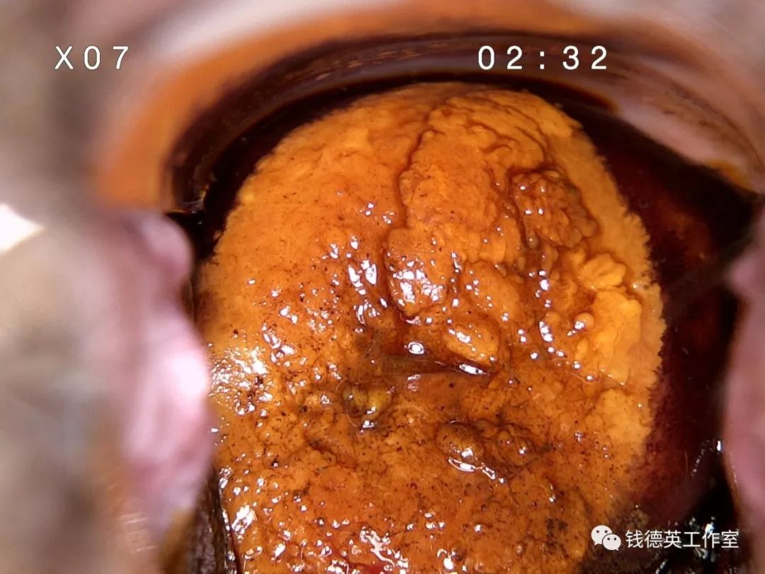 190619钱医生出诊记事