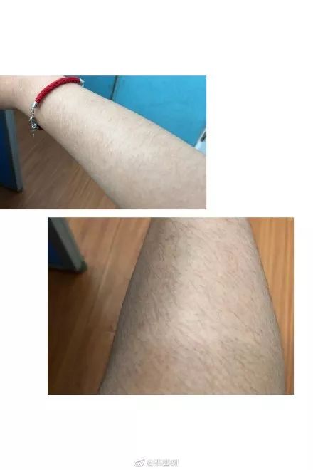 女生汗毛比男生长是一种什么体验