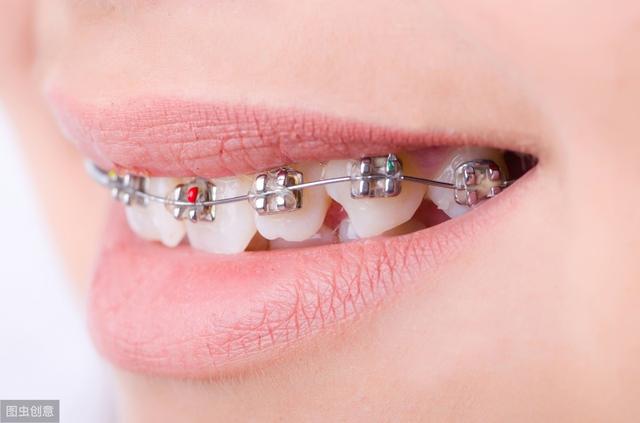 成年人就不能矫正牙齿了那你就大错特错了