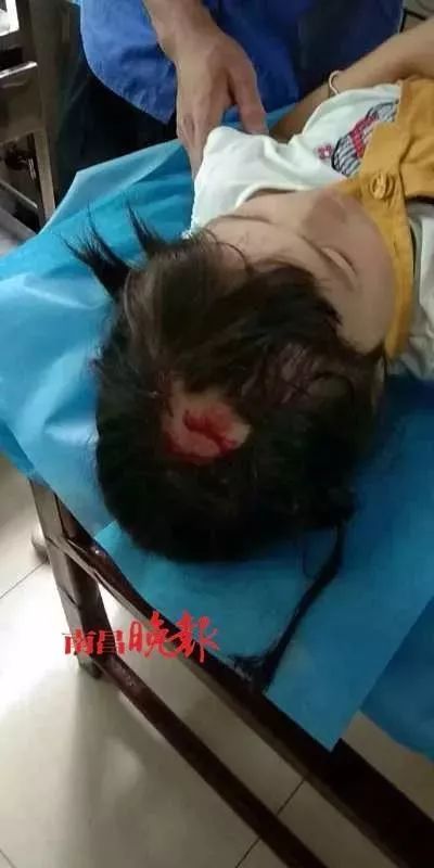 高空坠物!伤害,不止一点点!