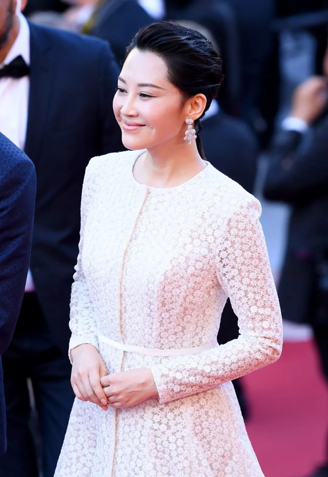 "不老女神"许晴疑似打针,颜值跌出下限,女明星何苦如此焦虑?