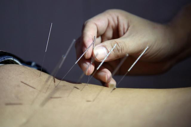 3,针灸调理平素气虚之人宜常服金匮薯蓣丸.