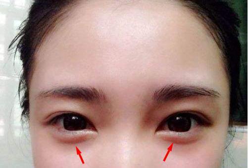 天生卧蚕饱满的女孩子,确实是被老天偷偷宠爱的好孩子!你有吗