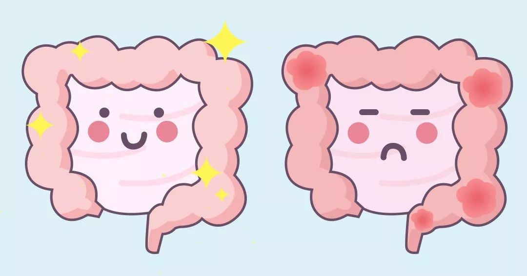 清肠搭档| 法国原材膳食纤维x益生菌,促蠕动平小腹一身轻松!_肠道