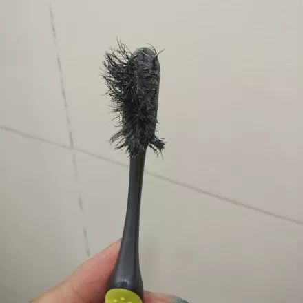 【科普】为什么我的牙齿越刷越不健康?_牙刷