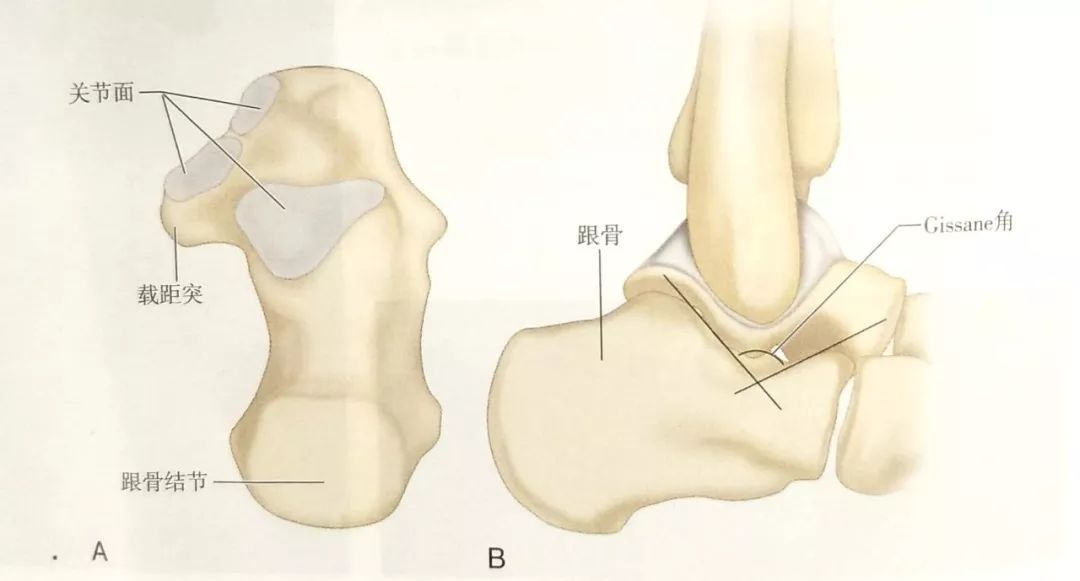 跟骨结节关节角图片