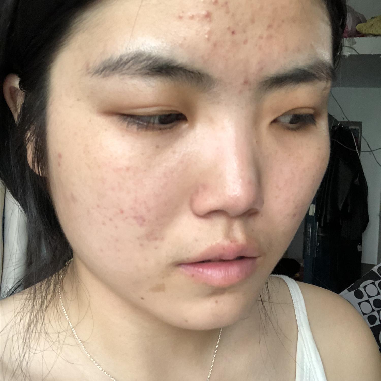 面对百斑刁难咱们怎么反击