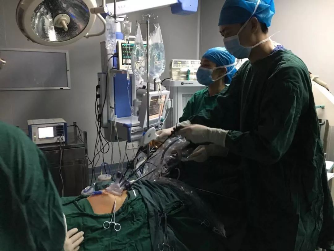 永福县人民医院妇科成功开展首例 单孔腹腔镜下全子宫切除手术