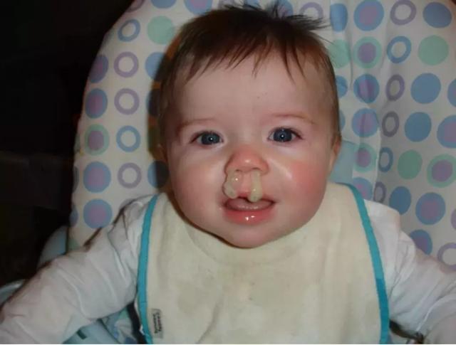 孩子的鼻涕出现这颜色千万别当成感冒立刻去医院