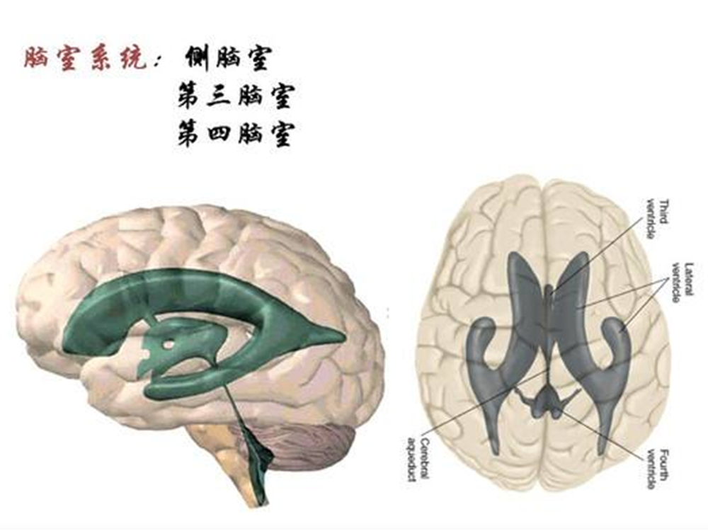 侧脑室宽图片