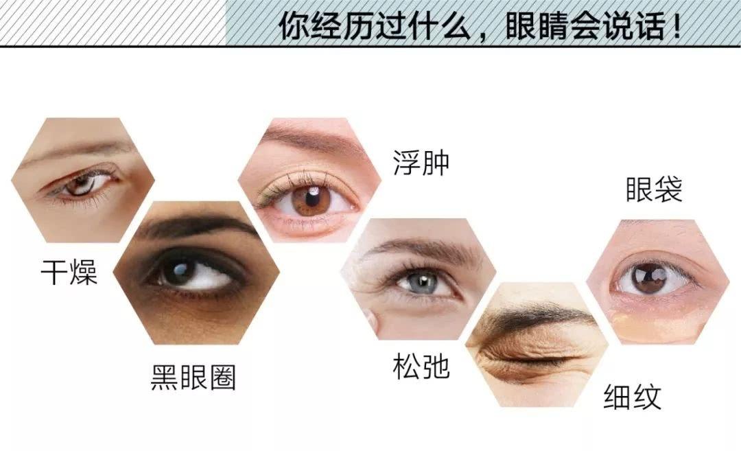 去掉了眼周纹,迎来了脂肪粒?这个锅到底该不该眼霜背?