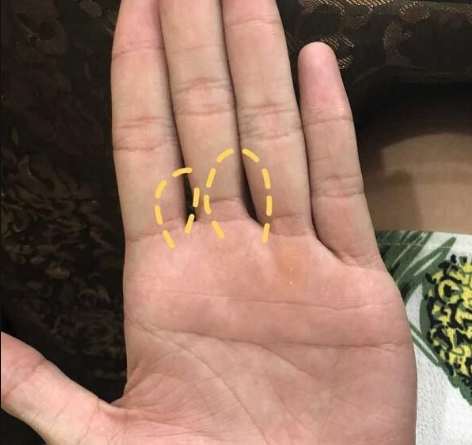 胃不好的人,手上会出现"三处变色,两处异常",指的是什么?_手掌