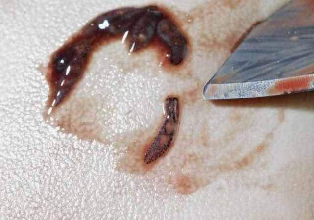 小龙虾体内到底有没有寄生虫专家检测过后结果让人意外