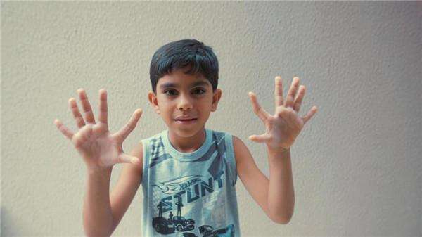 有些六根手指的人可单手系鞋带研究他们或可实现改造人类肢体