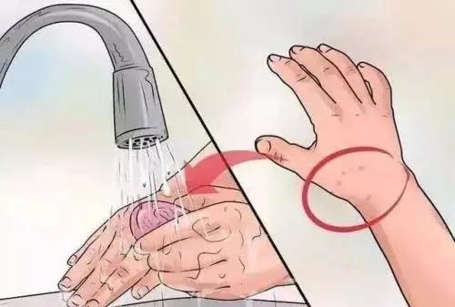 在酸性环境下进行复制,繁殖;正确操作:误区:不出血就不用管猫狗抓伤4