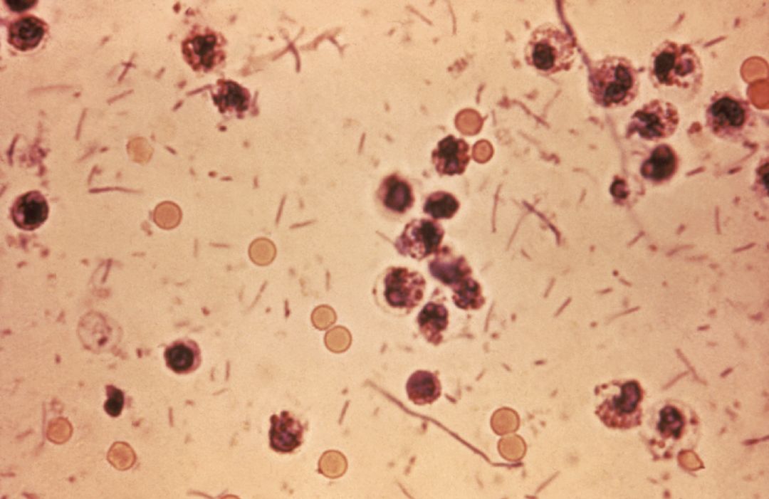 痢疾杆菌图片显微镜图片