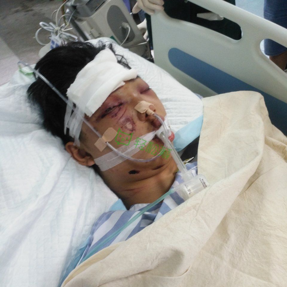 我的儿子今年16岁,2019年6月19日,因出车祸送到汕头中心医院,他被查