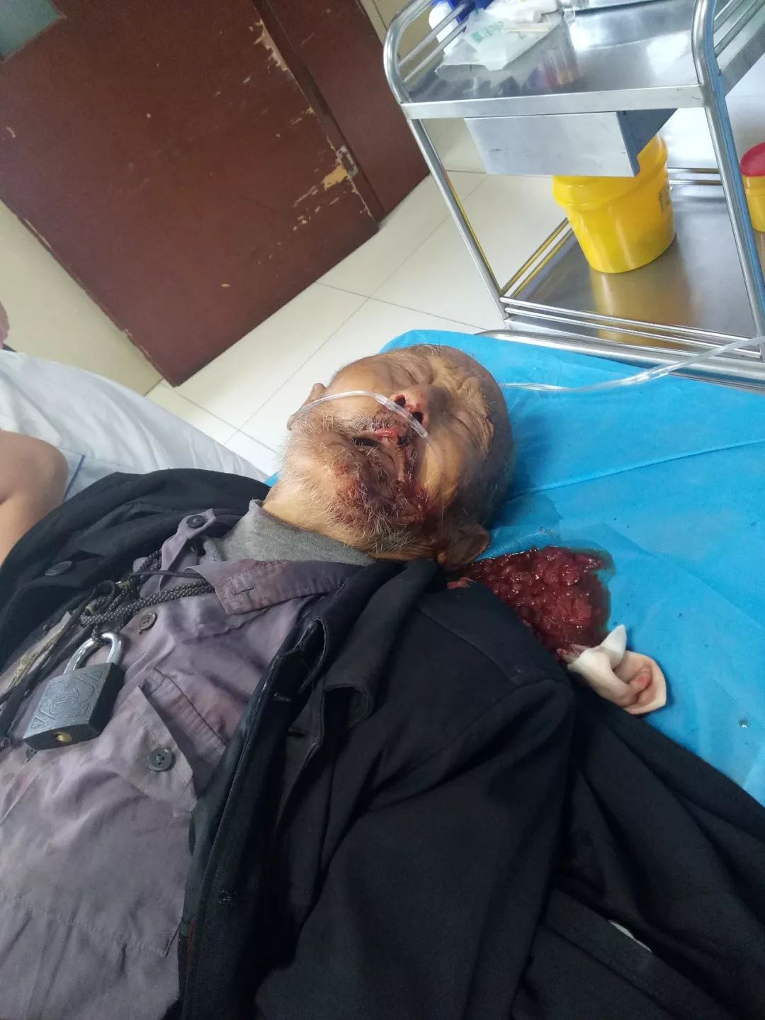 沈巷交警求助,老人重伤住院,急寻老人家属!