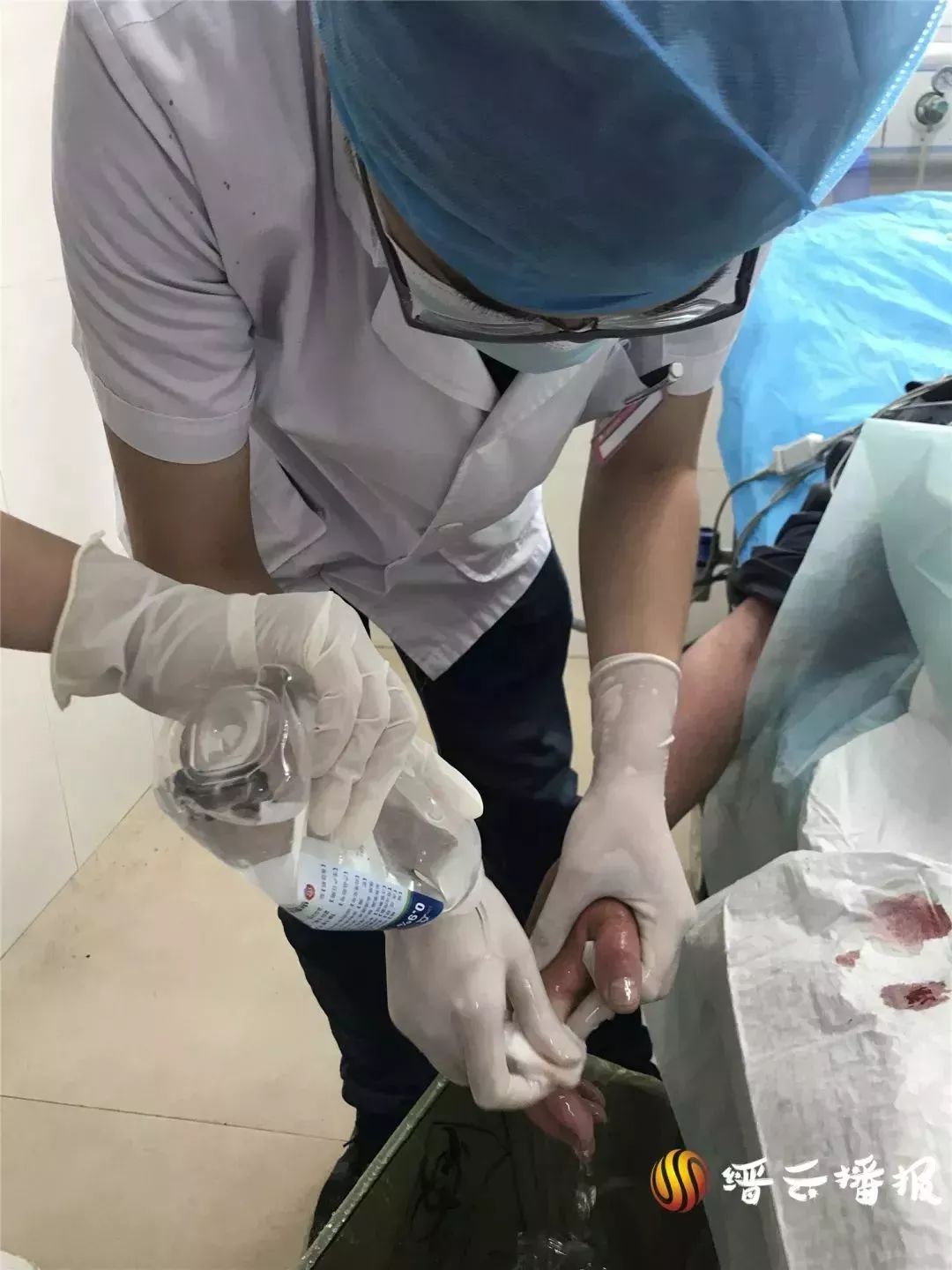 危急丽水一71岁老汉被毒蛇咬伤生命危在旦夕