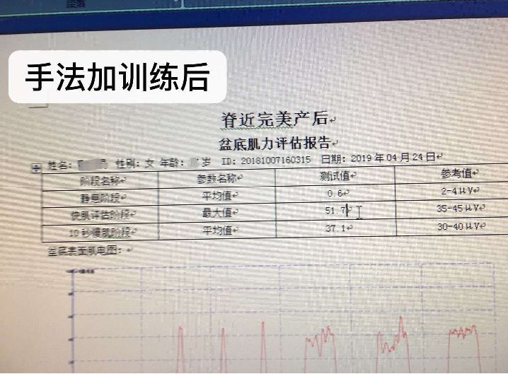 感神經問題往往導致腰痛性功能障礙與腰痛密切相關漏尿處方1 針刺腎腧