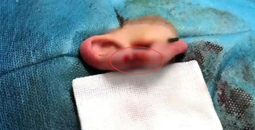 担心的事发生了:女子理发时耳朵被剪,连跑两家医院发现