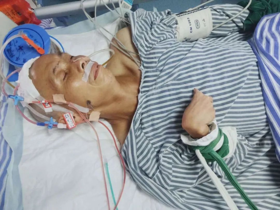 阴功德庆一对夫妻相继患病住院病情危急两幼子孤独留守