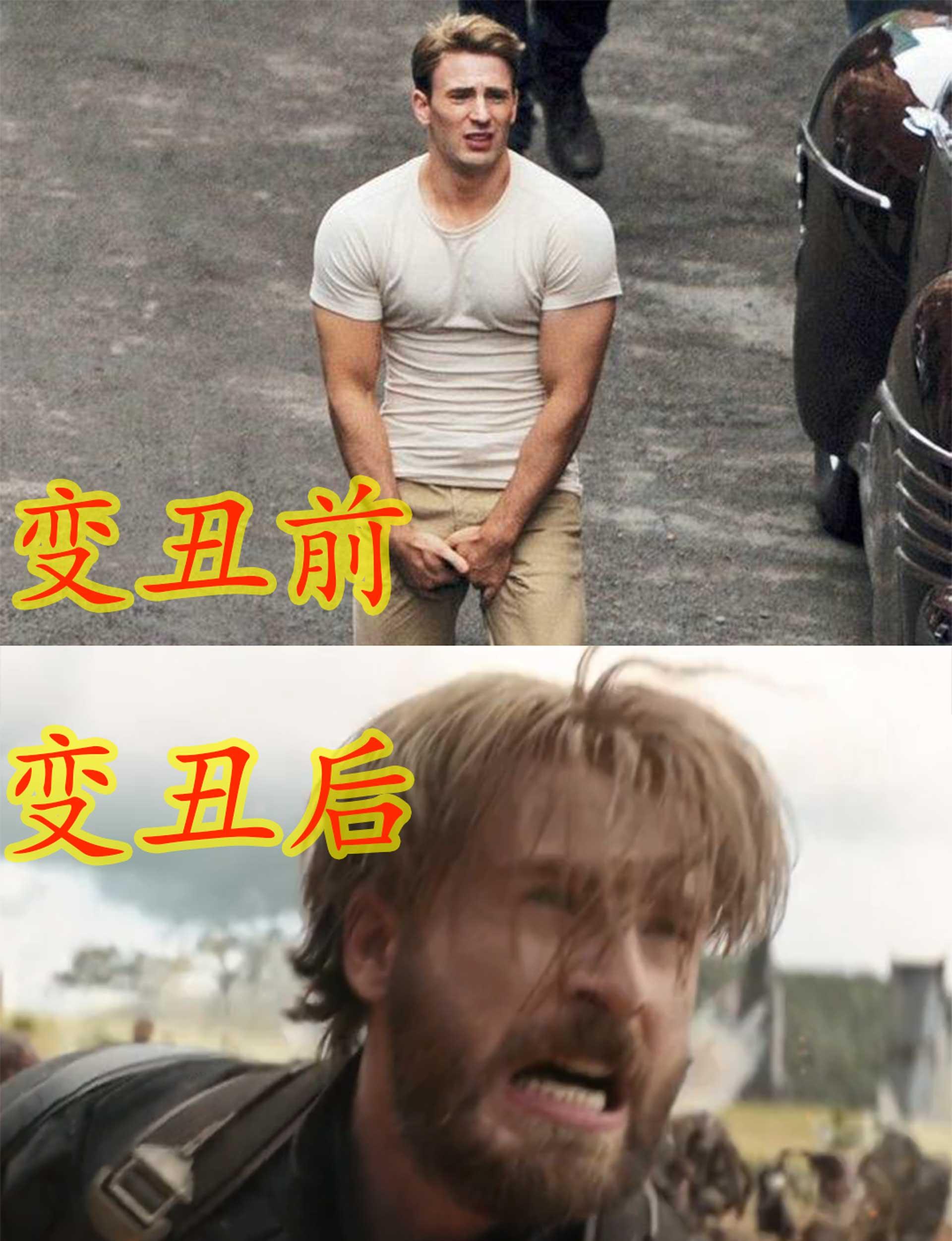星云光头,死侍改造毁容,仅邋遢的他还有得救!