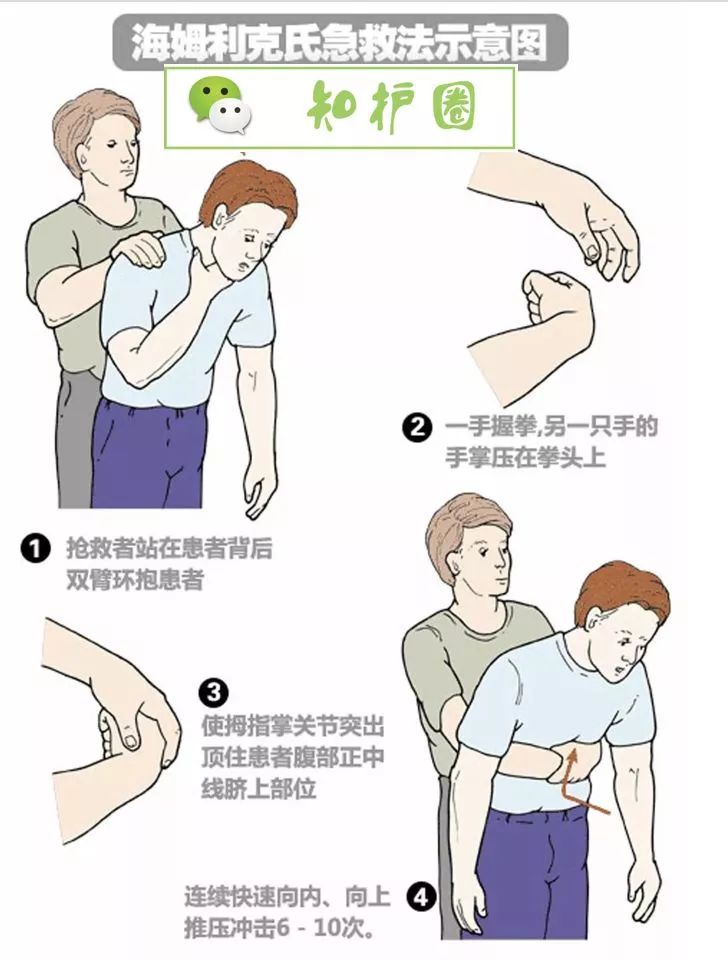 比心肺复苏还重要的海姆立克急救法,护士们赶紧练起来吧!