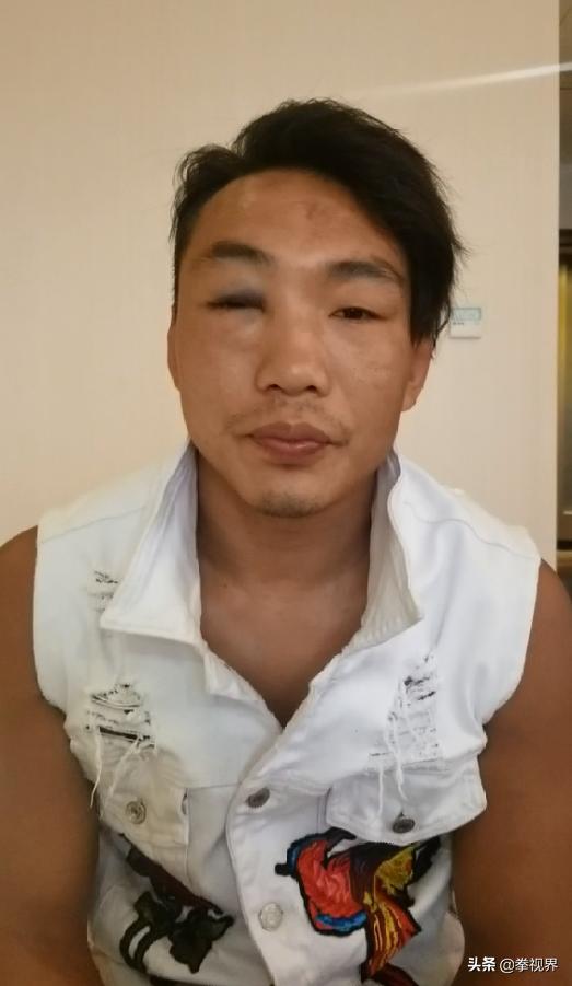 信宜市陈市长赛后看望魔童崔刘才魔童虽受伤但无大碍