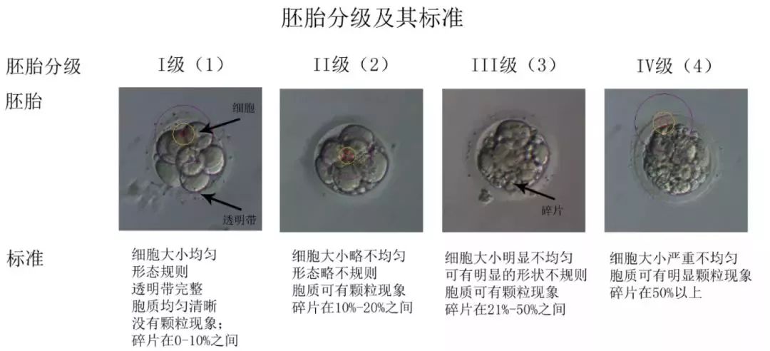 试管婴儿的胚胎等级划分 1a级也就是优质的胚胎,a级胚胎的卵裂球折射