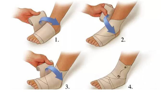 干货分享练习舞蹈时肌肉拉伤不知道怎么办这篇文章告诉你