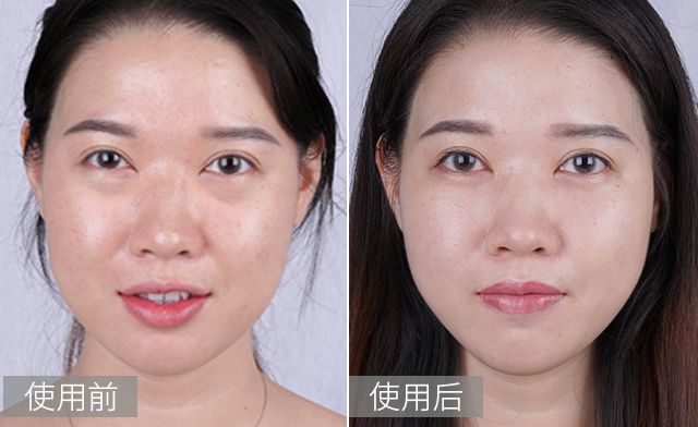 亲测:这样"祛眼袋",眼睛永远留在18岁!_精华