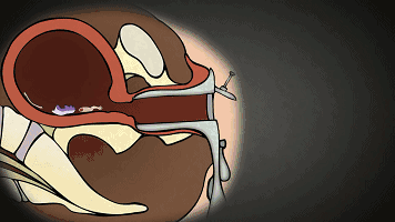 避孕药具可免费领取避孕大法掌握好让你无后顾之忧