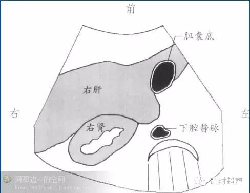 1-2-4膽囊頸部橫切面1-2-5膽囊縱切面,包括右腎