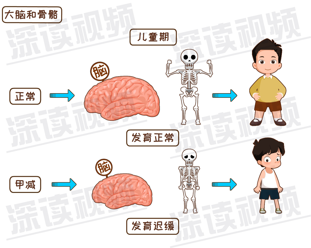 儿童甲减会导致大脑和骨骼的发育都严重滞后于同龄人,导致孩子智力低